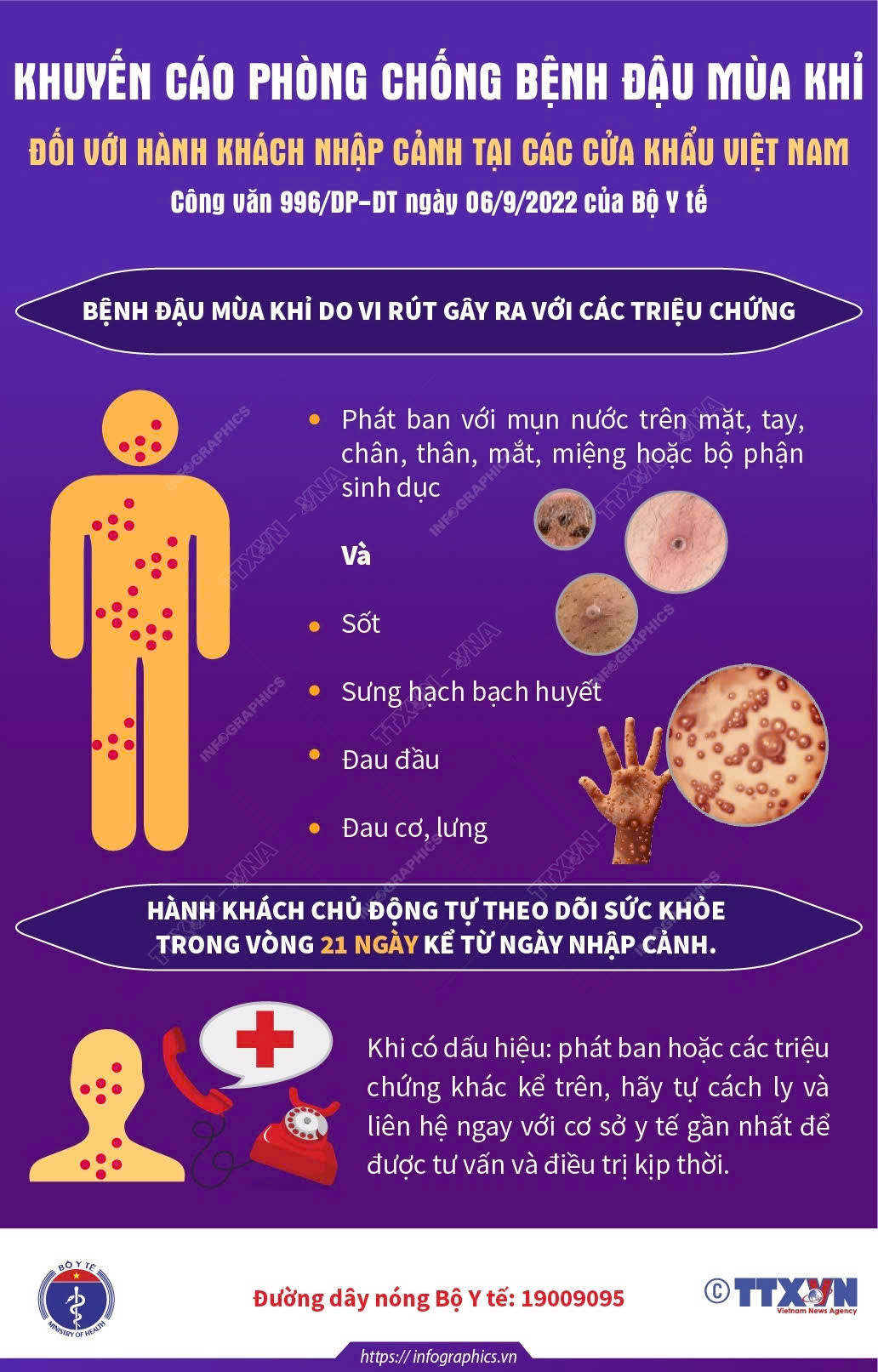 Khuyến cáo phòng chống bệnh Đậu mùa khỉ đối với hành khách nhập cảnh