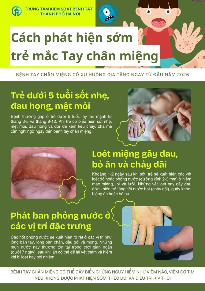 Cách phát hiện sớm trẻ mắc tay chân miệng