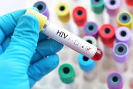Chẩn đoán sớm nhiễm HIV cho trẻ dưới 18 tháng tuổi