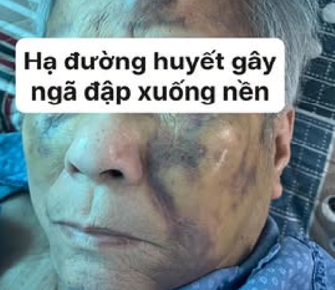 Hạ đường huyết: Nỗi sợ hãi của người bệnh đái tháo đường